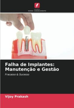 portada Falha de Implantes: Manutenção e Gestão: Fracasso & Sucesso