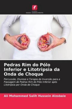 portada Pedras rim do Pólo Inferior e Litotripsia da Onda de Choque (en Portugués)