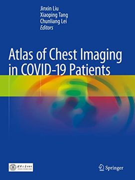 portada Atlas of Chest Imaging in Covid-19 Patients