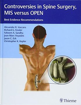 portada Controversies in Spine Surgery, MIS Versus Open: Best Evidence Recommendations (en Inglés)