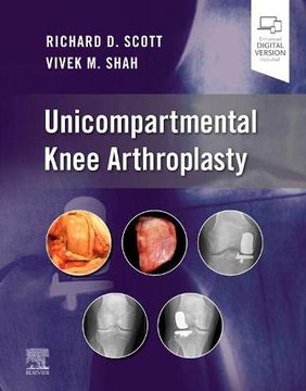 portada Unicompartmental Knee Arthroplasty (en Inglés)