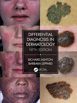 portada Differential Diagnosis in Dermatology (in English)