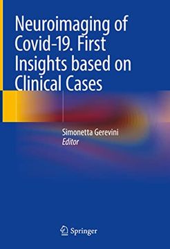 portada Neuroimaging of Covid-19. First Insights Based on Clinical Cases (in English)