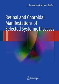 portada retinal and choroidal manifestations of selected systemic diseases (en Inglés)