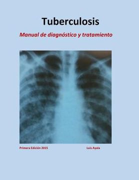 portada Tratamiento de Tuberculosis: Manual de diagnóstico y tratamiento