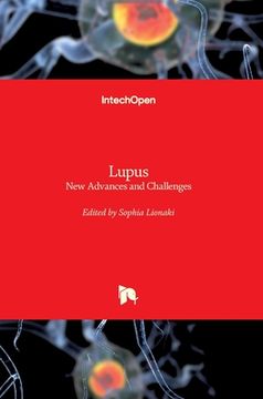 portada Lupus: New Advances and Challenges