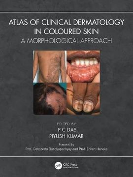 portada Atlas of Clinical Dermatology in Coloured Skin: A Morphological Approach (en Inglés)