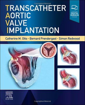 portada Transcatheter Aortic Valve Implantation (en Inglés)