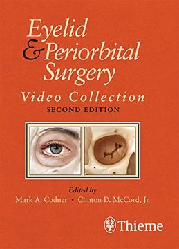 portada Eyelid and Periorbital Surgery Video Collection (in English)