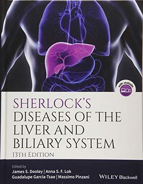 portada Sherlock's Diseases of the Liver and Biliary System (en Inglés)