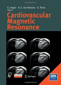 portada Cardiovascular Magnetic Resonance (in English)