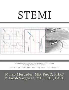 portada Stemi: 3-Minute Diagnosis, 90-Minute Reperfusion: Saving Time, Saves Lives (in English)