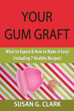 portada Your Gum Graft: What to Expect & How to Make it Easy! (Including 7 Healthy Recipes) (in English)