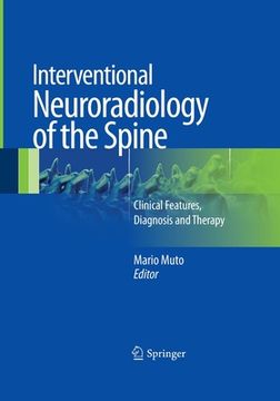 portada Interventional Neuroradiology of the Spine: Clinical Features, Diagnosis and Therapy 