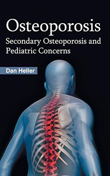 portada Osteoporosis: Secondary Osteoporosis and Pediatric Concerns (en Inglés)