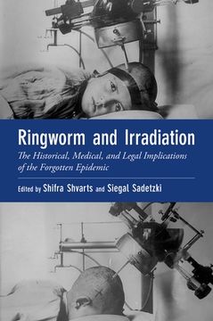 portada Ringworm and Irradiation: The Historical, Medical, and Legal Implications of the Forgotten Epidemic (Oxford Medical Online) (en Inglés)