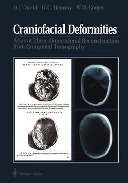 portada craniofacial deformities: atlas of three-dimensional reconstruction from computed tomography