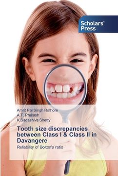 portada Tooth size discrepancies between Class I & Class II in Davangere