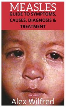 portada Measles: Guide to Symptoms, Causes, Diagnosis & Treatment (en Inglés)