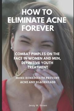 portada How to Eliminate Acne Forever: Combat Pimples on the Face in Women and Men, Definitive Juvenile Treatment, Home Remedies to Prevent Acne and Blackhea (en Inglés)