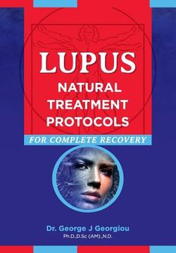 portada Lupus: Natural Treatment Protocols for Complete Recovery (en Inglés)