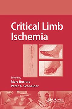 portada Critical Limb Ischemia (en Inglés)