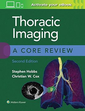 portada Thoracic Imaging: A Core Review (en Inglés)