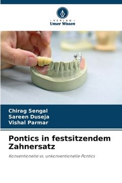 portada Pontics in festsitzendem Zahnersatz (en Alemán)