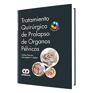 portada Tratamiento Quirurgico de Prolapso de Organos Pelvicos + dvd