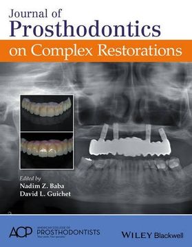 portada Journal of Prosthodontics on Complex Restorations (en Inglés)