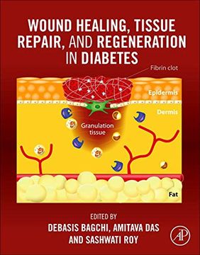 portada Wound Healing, Tissue Repair, and Regeneration in Diabetes (in English)