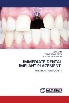 portada Immediate Dental Implant Placement (en Inglés)
