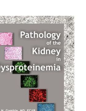 portada pathology of the kidney in dysproteinemia (in English)