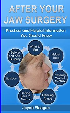 portada After Your Jaw Surgery: Practical and Helpful Information You Should Know