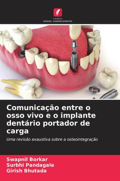 portada Comunicação Entre o Osso Vivo e o Implante Dentário Portador de Carga