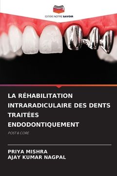 portada La Réhabilitation Intraradiculaire Des Dents Traitées Endodontiquement (en Francés)