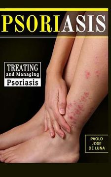 portada Psoriasis: Treating and Managing Psoriasis (en Inglés)
