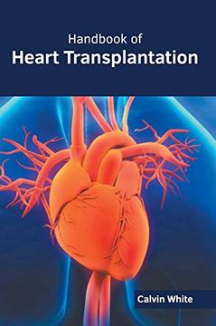 portada Handbook of Heart Transplantation 