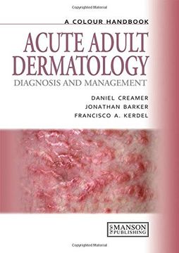 portada Acute Adult Dermatology: Diagnosis and Management: A Colour Handbook (Medical Color Handbook Series) (en Inglés)