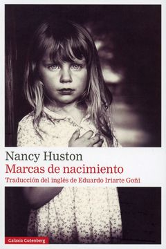 Marcas de Nacimiento