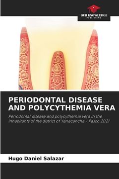 portada Periodontal Disease and Polycythemia Vera (en Inglés)