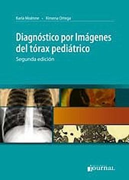 portada Diagnostico por Imagenes del Torax Pediatrico (in Spanish)