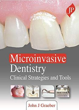 portada Microinvasive Dentistry: Clinical Strategies and Tools 