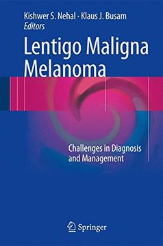 portada Lentigo Maligna Melanoma: Challenges in Diagnosis and Management (en Inglés)