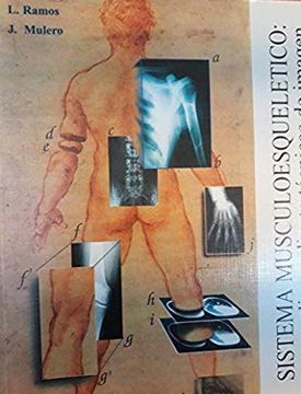 Sistema Musculoesqueletico: Su Estudio Mediante Tecnicas de Imagen