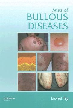portada atlas of bullous diseases (en Inglés)