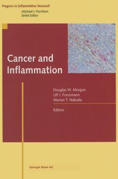 portada Cancer and Inflammation (Progress in Inflammation Research)