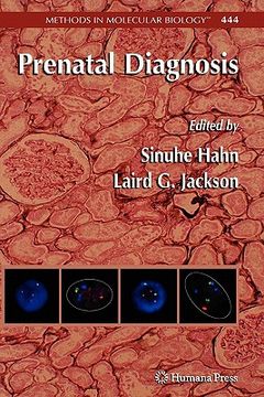 portada prenatal diagnosis (in English)