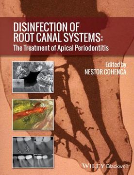 portada Disinfection of Root Canal Systems: The Treatment of Apical Periodontitis (en Inglés)