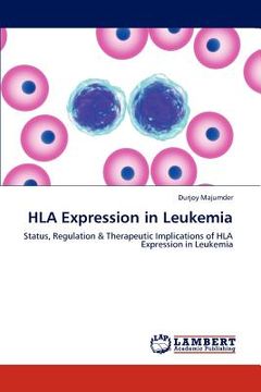portada hla expression in leukemia (en Inglés)